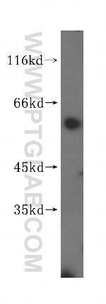 KLHDC4 Antibody in Western Blot (WB)