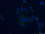 KRCC1 Antibody in Immunocytochemistry (ICC/IF)