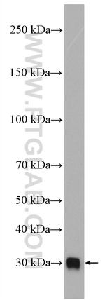 C1qB Antibody in Western Blot (WB)