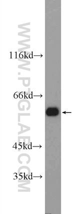 ATL3 Antibody in Western Blot (WB)