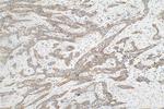 Calcyphosine Antibody in Immunohistochemistry (Paraffin) (IHC (P))