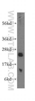 Calcyphosine Antibody in Western Blot (WB)