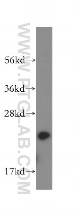 Calcyphosine Antibody in Western Blot (WB)