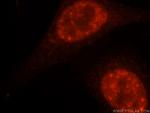 DDX46 Antibody in Immunocytochemistry (ICC/IF)