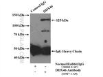 DDX46 Antibody in Immunoprecipitation (IP)