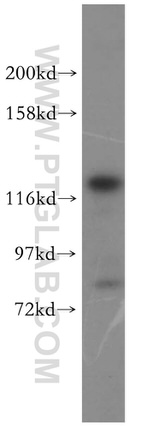 DDX46 Antibody in Western Blot (WB)