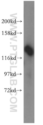 DDX46 Antibody in Western Blot (WB)