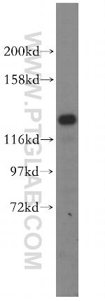 DDX46 Antibody in Western Blot (WB)
