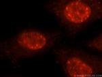 PRPF40B Antibody in Immunocytochemistry (ICC/IF)