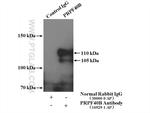 PRPF40B Antibody in Immunoprecipitation (IP)
