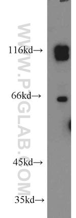 PRPF40B Antibody in Western Blot (WB)