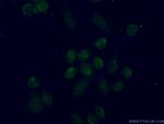 TBX2 Antibody in Immunocytochemistry (ICC/IF)