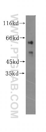ZNF35 Antibody in Western Blot (WB)