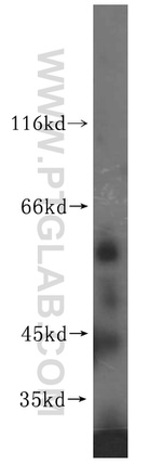 ZNF35 Antibody in Western Blot (WB)