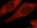 RNF10 Antibody in Immunocytochemistry (ICC/IF)