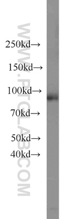 RNF10 Antibody in Western Blot (WB)