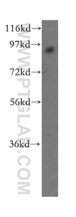 RNF10 Antibody in Western Blot (WB)