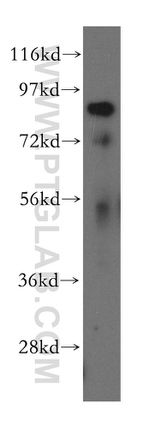 RNF10 Antibody in Western Blot (WB)