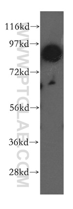 RNF10 Antibody in Western Blot (WB)