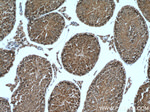 PHYHIPL Antibody in Immunohistochemistry (Paraffin) (IHC (P))