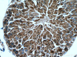 PHYHIPL Antibody in Immunohistochemistry (Paraffin) (IHC (P))