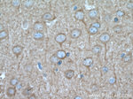 PHYHIPL Antibody in Immunohistochemistry (Paraffin) (IHC (P))