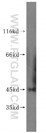 PHYHIPL Antibody in Western Blot (WB)