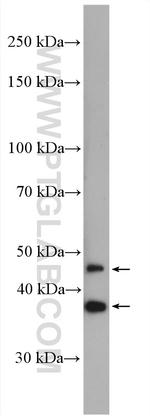PHYHIPL Antibody in Western Blot (WB)