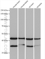 PHYHIPL Antibody in Western Blot (WB)