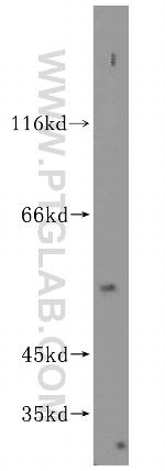 SPATS2L Antibody in Western Blot (WB)