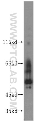 SPATS2L Antibody in Western Blot (WB)