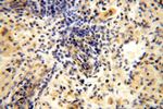 GALNT14 Antibody in Immunohistochemistry (Paraffin) (IHC (P))