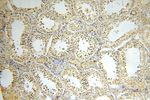 GALNT14 Antibody in Immunohistochemistry (Paraffin) (IHC (P))