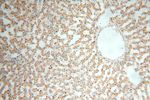 GALNT14 Antibody in Immunohistochemistry (Paraffin) (IHC (P))