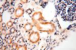 GALNT14 Antibody in Immunohistochemistry (Paraffin) (IHC (P))