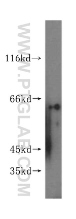 GALNT14 Antibody in Western Blot (WB)