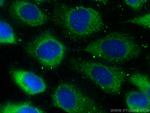 GAPVD1 Antibody in Immunocytochemistry (ICC/IF)