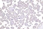 GAPVD1 Antibody in Immunohistochemistry (Paraffin) (IHC (P))