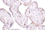 GAPVD1 Antibody in Immunohistochemistry (Paraffin) (IHC (P))