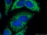 GFM2 Antibody in Immunocytochemistry (ICC/IF)