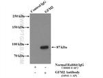 GFM2 Antibody in Immunoprecipitation (IP)