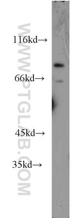 GFM2 Antibody in Western Blot (WB)