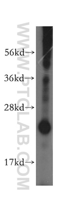 MOBKL2A Antibody in Western Blot (WB)