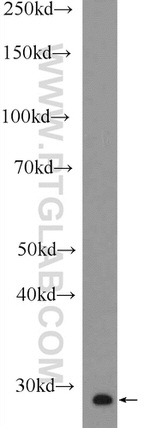 MOBKL2A Antibody in Western Blot (WB)
