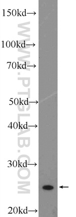 MOBKL2A Antibody in Western Blot (WB)