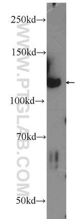 IWS1 Antibody in Western Blot (WB)