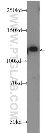 IWS1 Antibody in Western Blot (WB)
