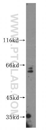 PARP6 Antibody in Western Blot (WB)