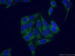 RPS21 Antibody in Immunocytochemistry (ICC/IF)