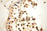 DCTN6 Antibody in Immunohistochemistry (Paraffin) (IHC (P))